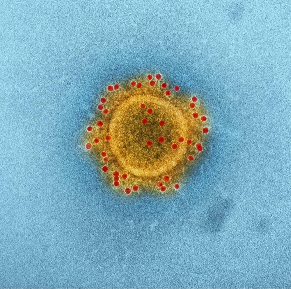yellow and red virus on blue background yellow and red virus on blue background