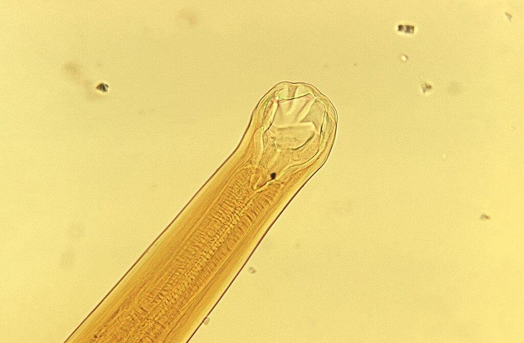 hookworm magnified hookworm magnified