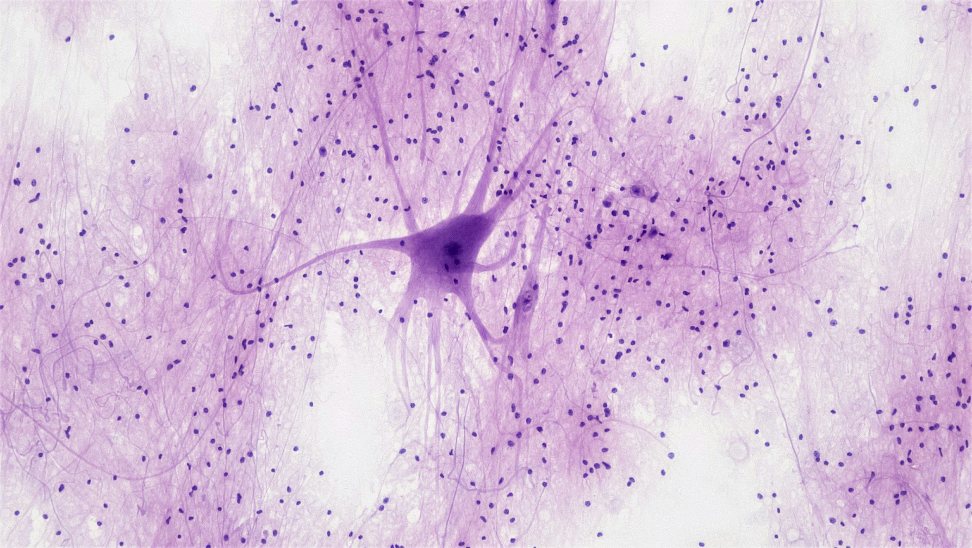 brain imaging