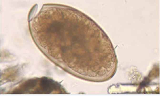 flukes under microscope